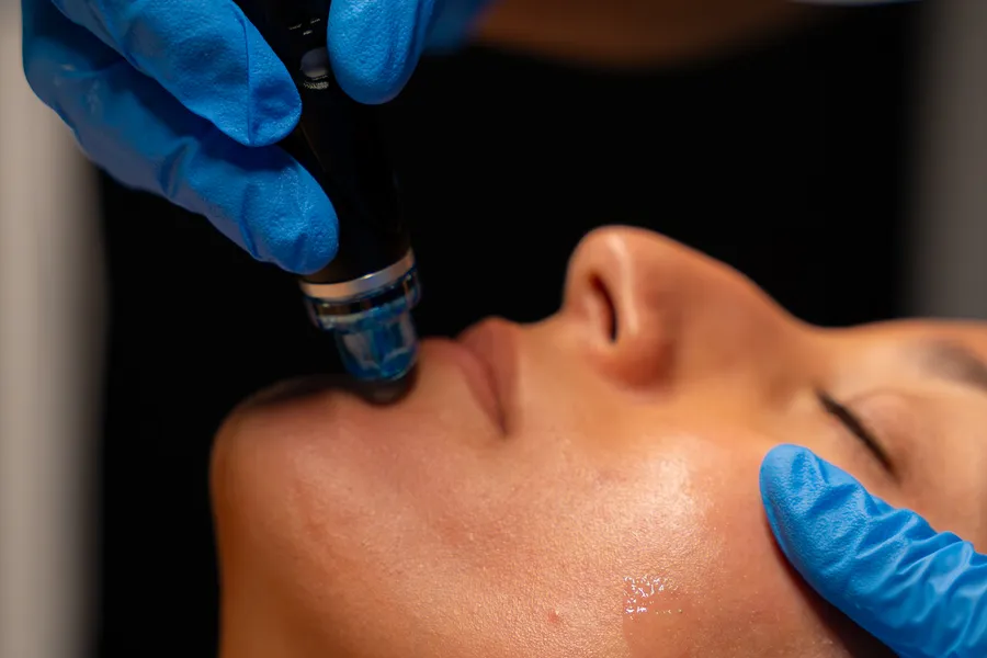 The HydraFacial handpiece at a guest's nose during extraction