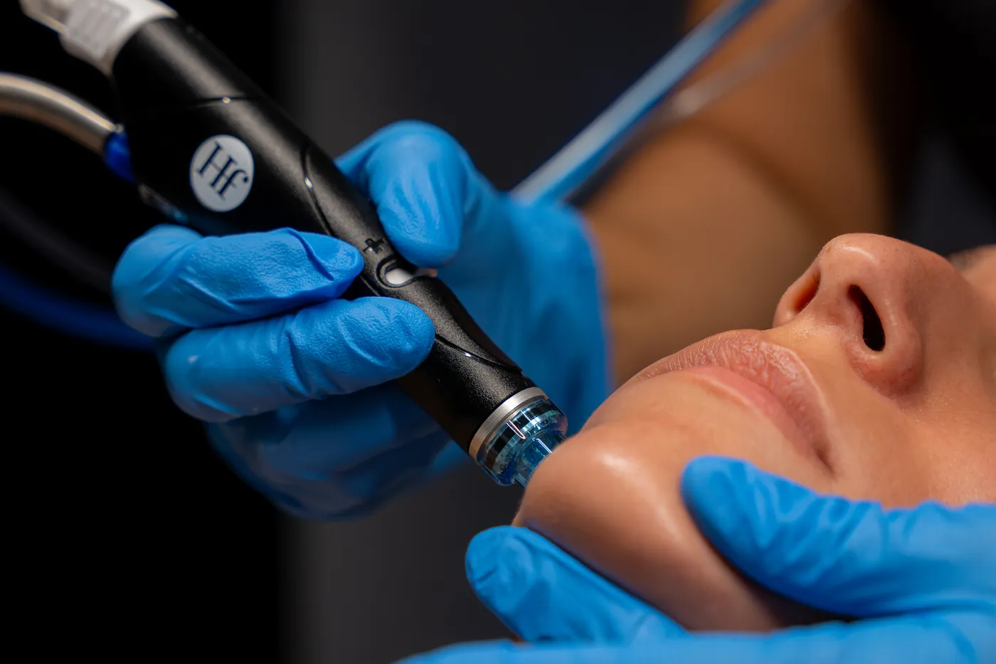 Close view of the HydraFacial handpiece on the skin